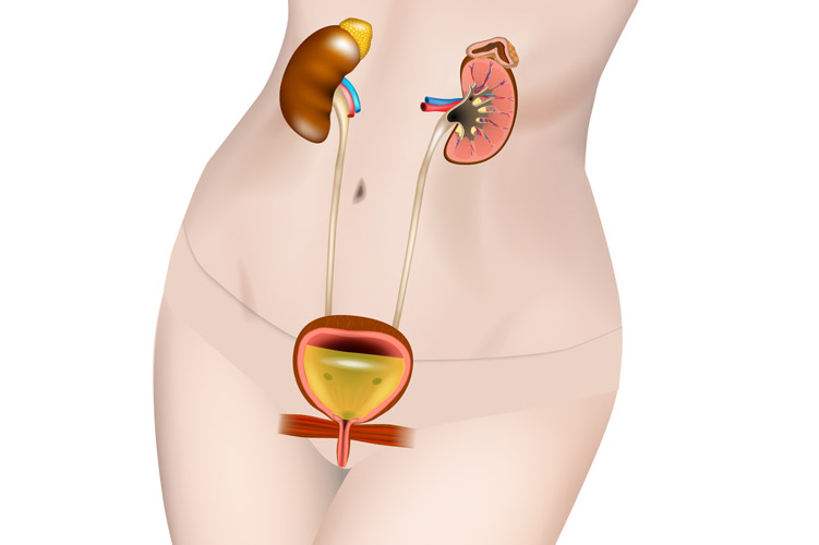 女性泌尿器科のイメージ画像